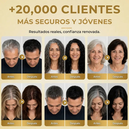 Belviora™|Recupera tu color natural desde la primera aplicación